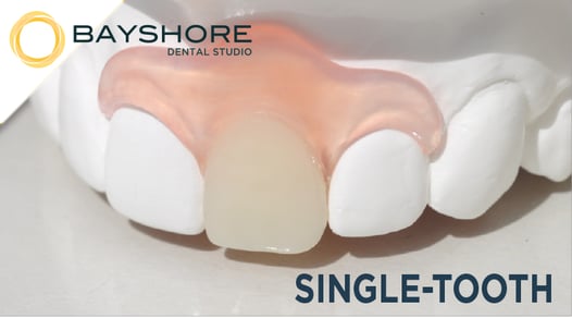 bayflex-single-tooth_logo